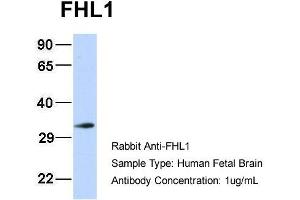 Host: Rabbit Target Name: FHL1 Sample Type: Human Fetal Brain Antibody Dilution: 1. (FHL1 antibody  (N-Term))