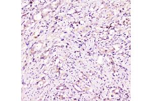 IHC analysis of TANK using anti-TANK antibody (ABIN6719508). (TANK antibody)