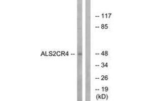 Western blot analysis of extracts from Jurkat cells, using ALS2CR4 Antibody. (TMEM237 antibody  (AA 181-230))