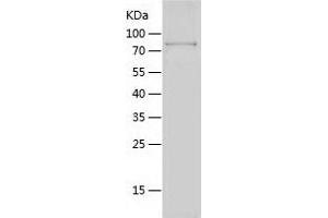 Western Blotting (WB) image for IKAROS Family Zinc Finger 2 (IKZF2) (AA 2-526) protein (His-IF2DI Tag) (ABIN7123401) (IKZF2 Protein (AA 2-526) (His-IF2DI Tag))