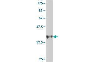 Western Blot detection against Immunogen (37. (MGAT4B antibody  (AA 401-500))