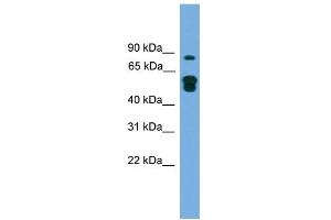 WB Suggested Anti-KIAA1609 Antibody Titration: 0. (KIAA1609 antibody  (N-Term))