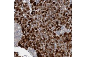 Immunohistochemical staining of human pancreas with FBF1 polyclonal antibody  shows strong cytoplasmic positivity in exocrine glandular cells. (FBF1 antibody)