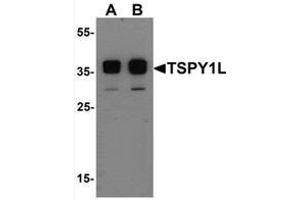 Western blot analysis of TSPY1L in A20 cell lysate with TSPY1L Antibody   at (A) 0. (TSPY1 antibody  (C-Term, Isoform 2))