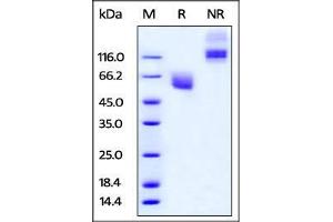 Cynomolgus CD47, Fc Tag on SDS-PAGE under reducing (R) and no-reducing (NR) conditions. (CD47 Protein (CD47) (AA 19-141) (Fc Tag))