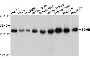 Western blot analysis of extracts of various cell lines, using SDHB antibody (ABIN4905102) at 1:1000 dilution. (SDHB antibody)