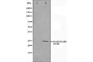 Western blot analysis on HeLa cell lysate using RASH/RASK/RASN Antibody,The lane on the left is treated with the antigen-specific peptide. (RASH/RASK/RASN antibody)