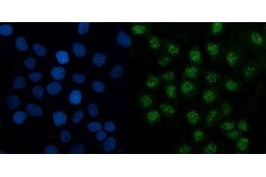 IF analysis of TMED5/p28 using anti-TMED5/p28 antibody (ABIN7601339). (TMED5 antibody  (AA 33-164))