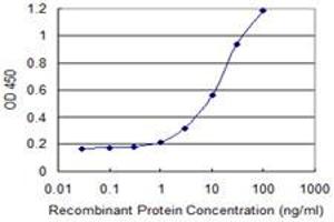 Detection limit for recombinant GST tagged RTDR1 is 0. (RTDR1 antibody  (AA 249-348))