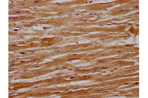 IHC image of ABIN7140094 diluted at 1:100 and staining in paraffin-embedded human heart tissue performed on a Leica BondTM system. (Importin 9 antibody  (AA 158-176))