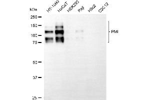 Western blotting analysis using PML antibody (ABIN7799924).