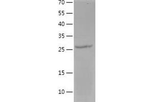 Western Blotting (WB) image for Membrane-Spanning 4-Domains, Subfamily A, Member 1 (MS4A1) (AA 141-188) protein (His-IF2DI Tag) (ABIN7285315) (CD20 Protein (AA 141-188) (His-IF2DI Tag))