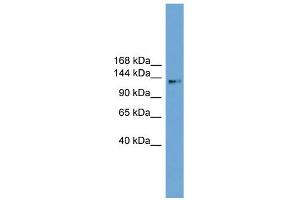 WB Suggested Anti-CCDC146 Antibody Titration: 0. (CCDC146 antibody  (Middle Region))