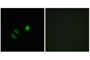 Immunofluorescence analysis of A549 cells, using OR4X1 antibody. (OR4X1 antibody  (C-Term))
