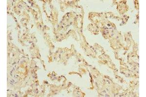 Immunohistochemistry of paraffin-embedded human lung tissue using ABIN7175319 at dilution of 1:100 (VPS4A antibody  (AA 1-120))