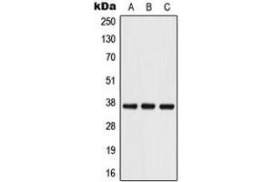 Western blot analysis of Podoplanin expression in HT1080 (A), Raw264. (Podoplanin antibody  (Center))