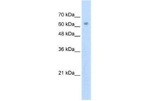 Human Jurkat; WB Suggested Anti-ZNF274 Antibody Titration: 2. (ZNF274 antibody  (N-Term))