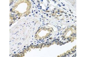 Immunohistochemistry of paraffin-embedded Human prostate using STXBP2 Polyclonal Antibody at dilution of 1:100 (40x lens).