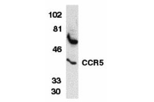 Western Blotting (WB) image for anti-Chemokine (C-C Motif) Receptor 5 (CCR5) (N-Term) antibody (ABIN1031308) (CCR5 antibody  (N-Term))