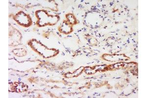 Formalin-fixed and paraffin embedded human kidney labeled with Anti-Protein kinase C beta, Isoform II Polyclonal Antibody, Unconjugated  at 1:200 followed by conjugation to the secondary antibody and DAB staining. (PKC beta antibody  (AA 601-673))