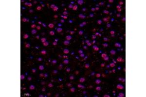 Immunofluorescence of paraffin embedded mouse liver using USP24 (ABIN7076111) at dilution of 1:650 (400x lens) (USP24 antibody)