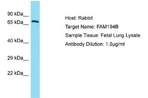 Host: Rabbit Target Name: FAM194B Sample Type: Fetal Lung lysates Antibody Dilution: 1. (FAM194B antibody  (C-Term))