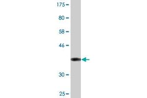Western Blot detection against Immunogen (36. (Superoxide dismutase copper chaperone antibody  (AA 175-274))