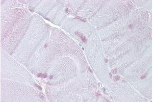 Immunohistochemistry with Skeletal muscle tissue at an antibody concentration of 5µg/ml using anti-TEF antibody (ARP38279_P050)