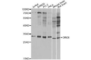 Western blot analysis of extracts of various cell lines, using ORC6 antibody (ABIN5973151) at 1/1000 dilution. (ORC6 antibody)