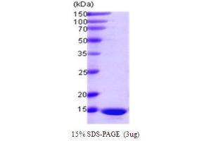 SDS-PAGE (SDS) image for Programmed Cell Death 5 (PDCD5) (AA 1-125) protein (ABIN667714) (PDCD5 Protein (AA 1-125))