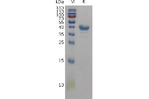 CD59 (CD59) (AA 26-102) protein (Fc Tag)