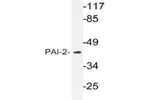 Western blot (WB) analyzes of PAI-2 antibody in extracts from MCF-7 cells. (SERPINB2 antibody)