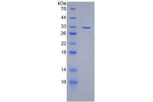SDS-PAGE analysis of Mouse Lymphotoxin beta Protein.