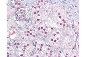Immunohistochemistry (IHC) image for anti-Nuclear Receptor Subfamily 4, Group A, Member 1 (NR4A1) (AA 324-373) antibody (ABIN6748603)