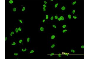 Immunofluorescence of monoclonal antibody to MCM2 on HeLa cell. (MCM2 antibody  (AA 805-904))