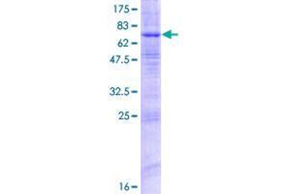 ZDHHC9 Protein (AA 1-364) (GST tag)