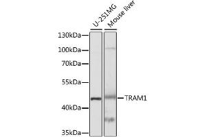 Western blot analysis of extracts of various cell lines, using TRAM1 antibody. (TRAM1 antibody)