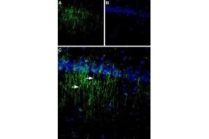 Expression of CaSR in rat brain - Immunohistochemical staining of rat hippocampal CA1 region using Anti-Calcium Sensing Receptor (extracellular) Antibody (ABIN7043018, ABIN7044161 and ABIN7044162). (CASR antibody  (Extracellular, N-Term))