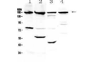 Western blot analysis of ErbB 4 using anti-ErbB 4 antibody .