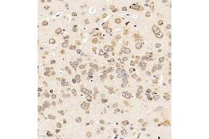 Immunohistochemistry of paraffin embedded mouse brain using LEG8 (ABIN7074474) at dilution of 1:1000 (300x lens) (LGALS8 antibody)