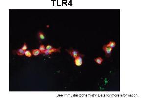 Immunohistochemistry (IHC) image for anti-Toll-Like Receptor 4 (TLR4) (Middle Region) antibody (ABIN2787920)
