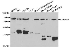 Western blot analysis of extracts of various cell lines, using CHRNA1 antibody. (CHRNA1 antibody  (AA 105-220))
