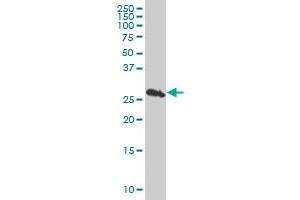 PSMB10 monoclonal antibody (M01), clone 3F8 Western Blot analysis of PSMB10 expression in Jurkat . (PSMB10 antibody  (AA 1-273))