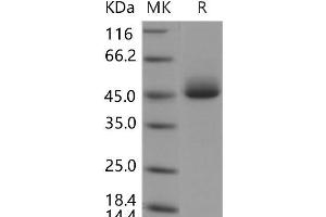 Western Blotting (WB) image for Acid Phosphatase, Prostate (ACPP) protein (His tag) (ABIN7320069) (ACPP Protein (His tag))