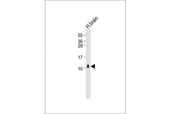 S100B antibody