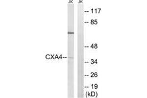 Western blot analysis of extracts from Jurkat cells, using GJA4 Antibody.