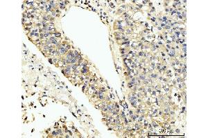 IHC analysis of LARP4B using anti-LARP4B antibody (ABIN7600865). (LARP4B antibody  (AA 241-684))