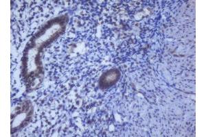 Image no. 11 for anti-DEAD (Asp-Glu-Ala-Asp) Box Polypeptide 59 (DDX59) (AA 1-303) antibody (ABIN1490728)