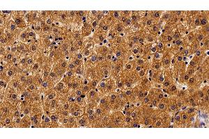 Detection of ALCAM in Human Liver Tissue using Monoclonal Antibody to Activated Leukocyte Cell Adhesion Molecule (ALCAM) (CD166 antibody  (AA 28-527))