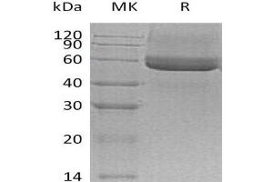 SPOCK3 Protein (His tag)